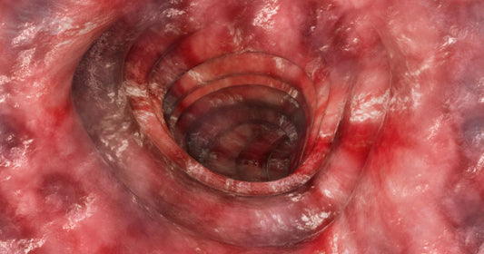 Lose Weight Fast! by Spring Chenjp