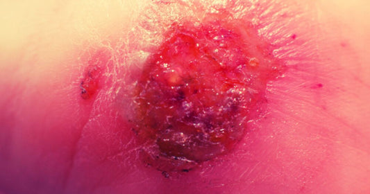 They Lurk Underneath by Andrew Kurtz